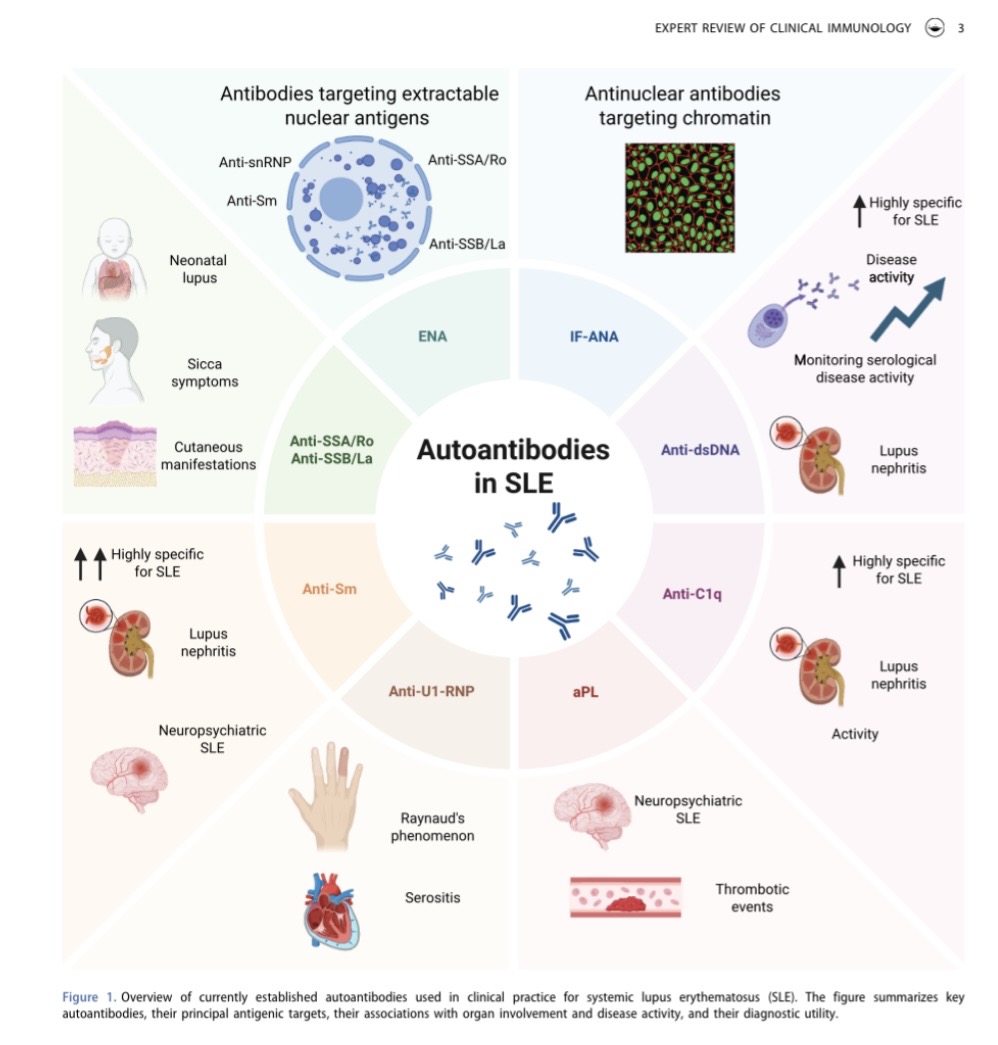 Owner_X429's tweet photo. Old and new autoantibodies in systemic lupus erythematosus https://t.co/JgdlbYRs3J