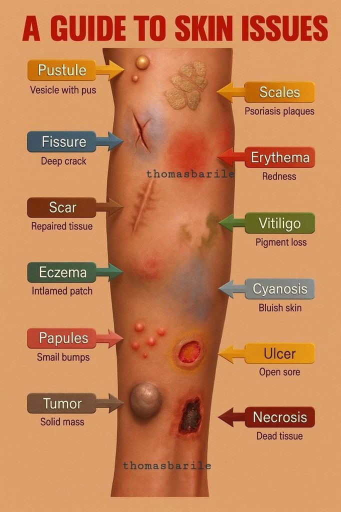 Dposts7's tweet image. A Guide to skin issues