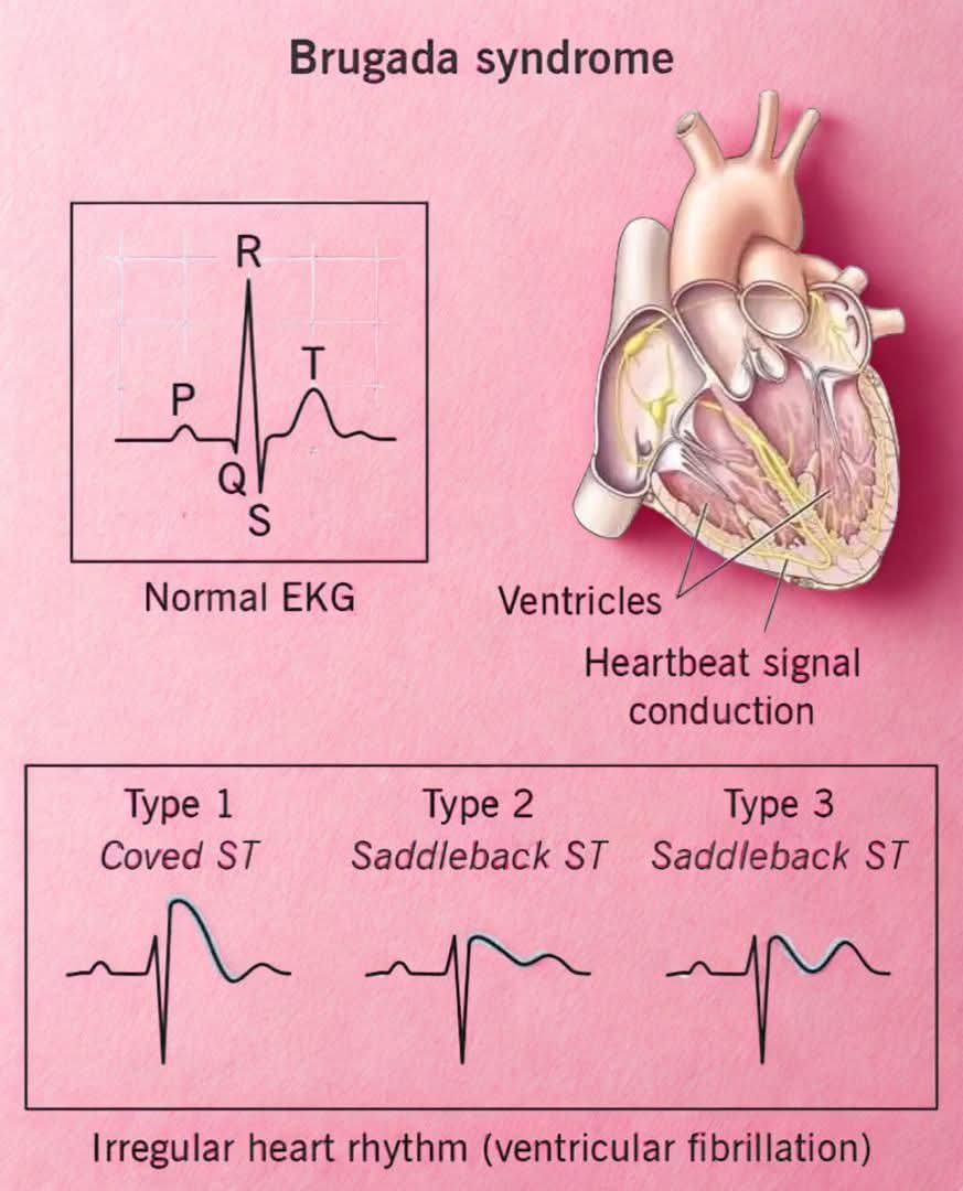 Leticia bravo Aldecoa 🧠 & ♥ (@aldecobravo) on Twitter photo 