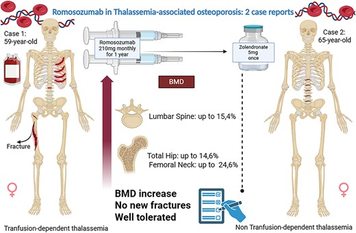 doctorneyro's tweet image. #Romosozumab is an #effective nd #safe #anabolic  for patients with #thalassemia and high #fracturerisk.

While #antiresorptivetherapy remains standard of care, #romo may provide additional #benefit in thalassemia with severe osteoporosis nd increased #FR

academic.oup.com/jbmrplus/advan…