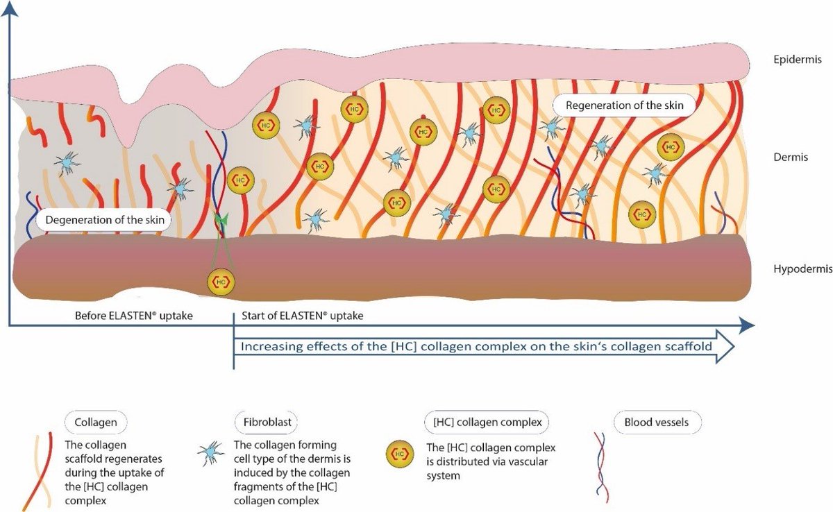 Nutrients_MDPI's tweet image. #HighlyViewedPaper
A #Collagen  Supplement Improves #Skin Hydration, Elasticity, Roughness, and Density:  Results of a Randomized, Placebo-Controlled, Blind Study
by Liane Bolke et al. @MediPharma_MDPI
Welcome to read: mdpi.com/2072-6643/11/1…