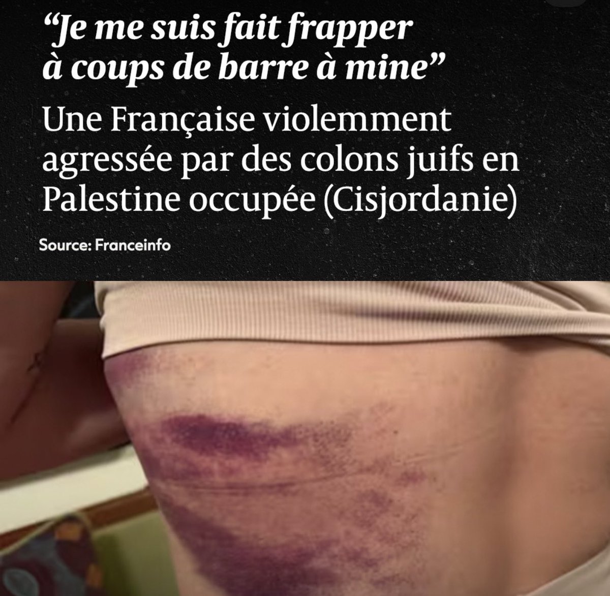 KarimZeribi's tweet photo. Imaginez la même agression commise dans un pays Africain. Flashs infos en continu, éditos indignés, débats sur “l’ensauvagement”, le“choc des civilisations”, la“barbarie”. Quand ce sont des colons en Cisjordanie ça devient une simple brève.Ce 2 poids, 2 mesures est insupportable! https://t.co/YS9i9vyJgi