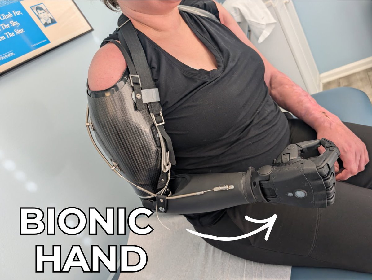 Open Bionics tweet media