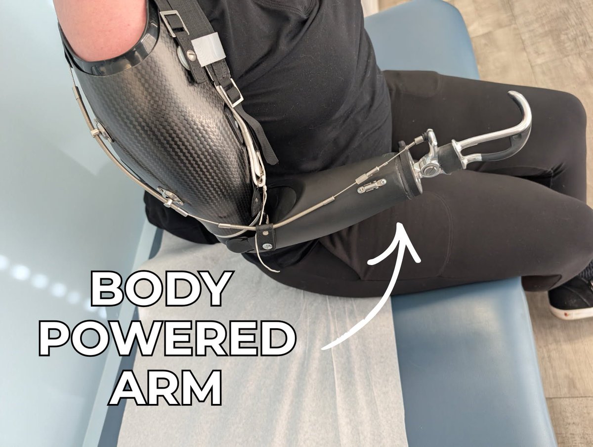 Open Bionics tweet media