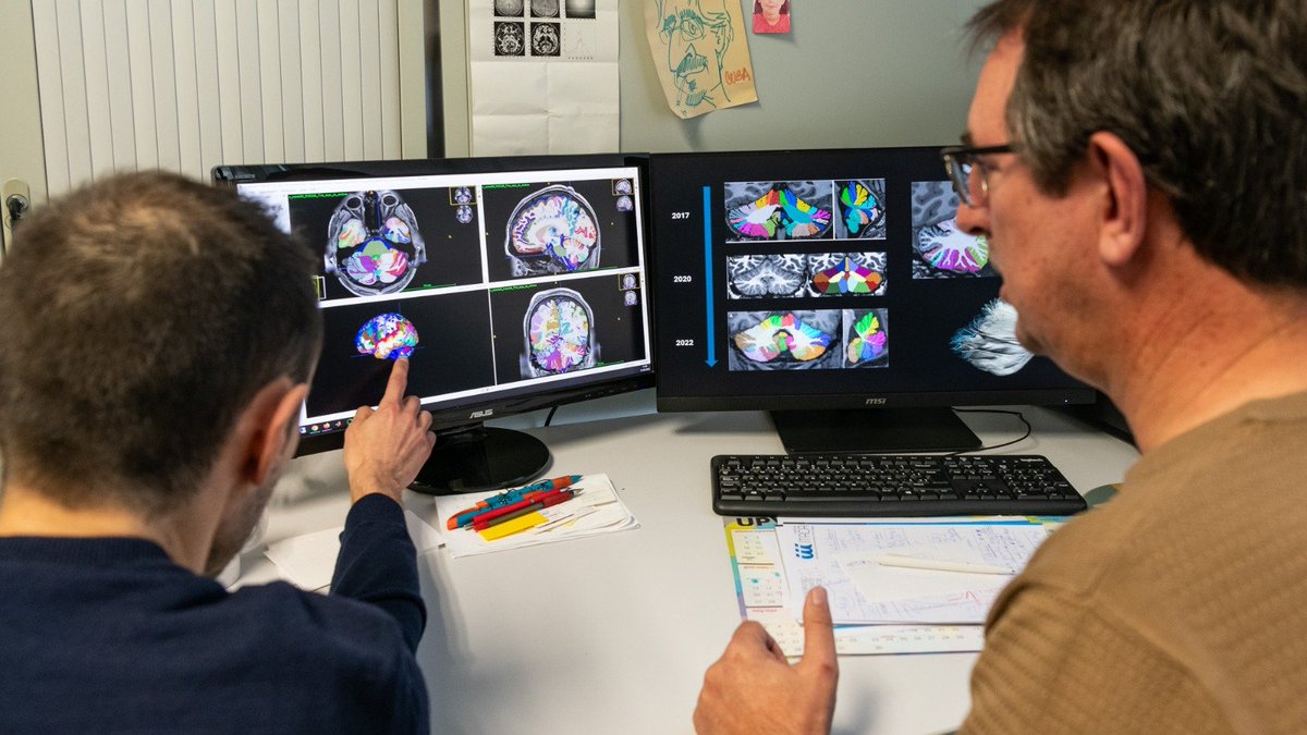 itacaUPV's tweet photo. 🟡On #WorldEpilepsyDay, our MIA LAB group reaffirms its commitment to improving the quality of life of people living with this neurological disorder
😃With #volBrain, a tool for the development of multiple clinical and research studies in neuroimaging.
🗞️ https://t.co/rfGJPKAAw7 https://t.co/paZ4Uca8Hj