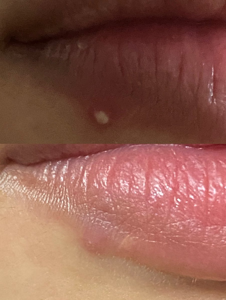 this is my current skincare routine yang bikin jerawat ilang dalam waktu less than 3 hari✨