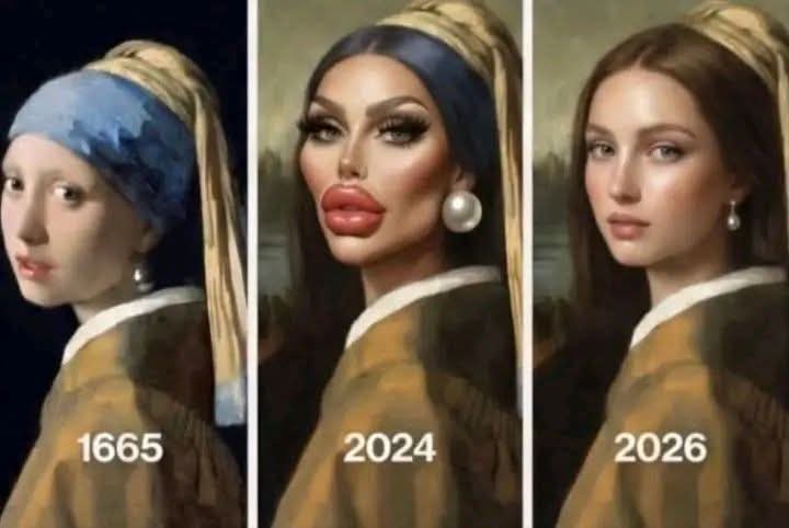 MomsPostingLs's tweet image. No women with duck Lips looks good