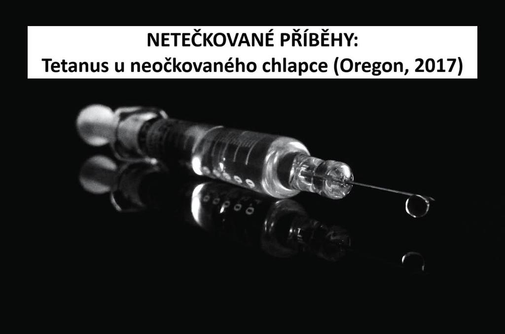 ❌NETEČKOVANÉ PŘÍBĚHY: Tetanus u neočkovaného chlapce (Oregon, 2017)

Tento případ je jedním z nejlépe zdokumentovaných v moderní medicíně.
facebook.com/share/p/1G6bpH…