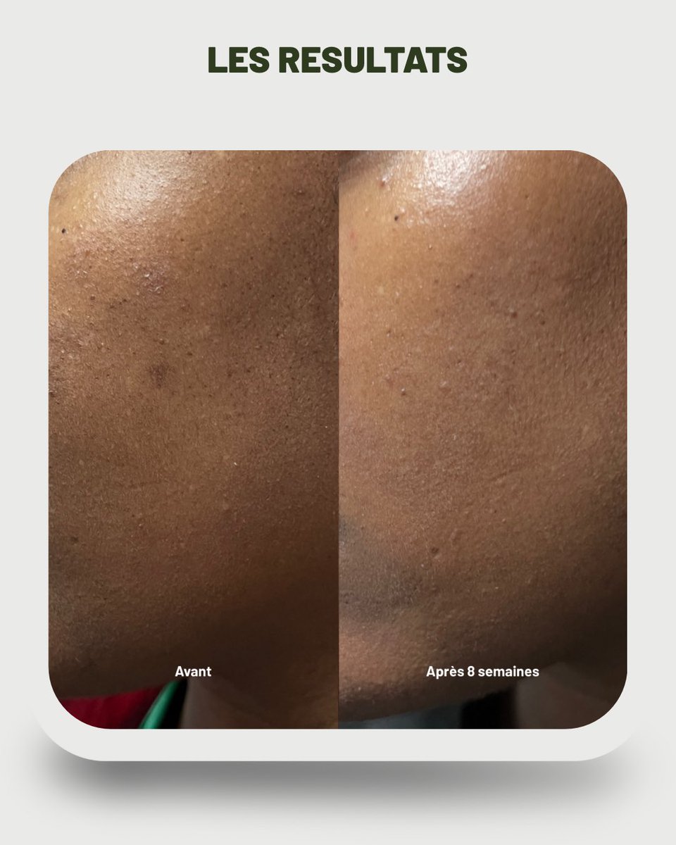 Millena 🇨🇲 🇪🇸 tweet media