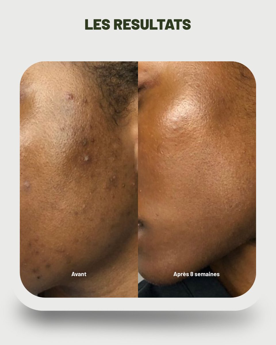 Millena 🇨🇲 🇪🇸 tweet media