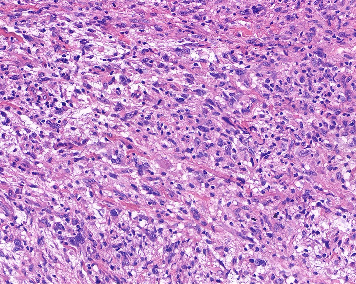 Surgical Pathology Cases tweet media