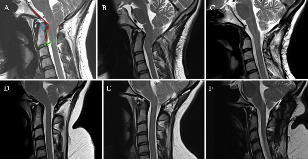 Journal of Neurosurgery tweet media