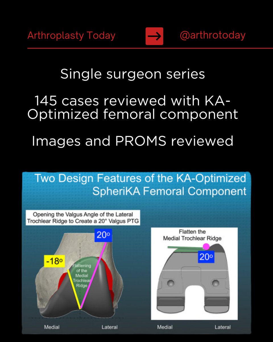 Arthroplasty Today tweet media