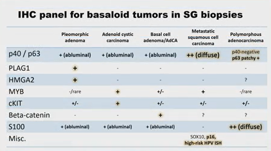 Janiranavarro's tweet image. IHC panel for basaloid tumors in salivary gland biopsies

Dr. Nishino - 2025 Diagnostic Pathologic Update #USCAP #pathology #PathX