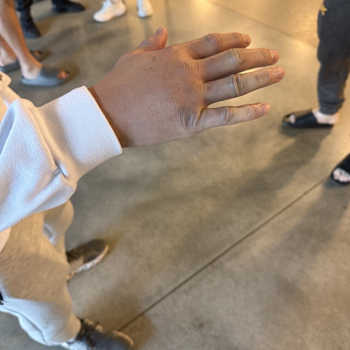 AmericanTopTeam's tweet photo. Kyoji sans hand. https://t.co/YGbZvuzPAz