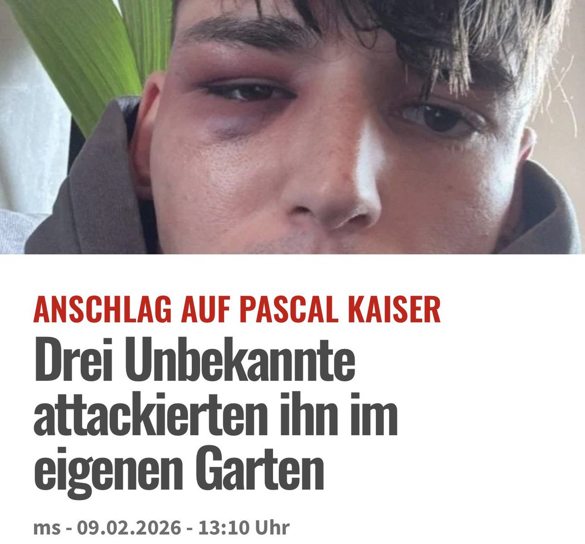 ANSCHLAG AUF PASCAL KAISER: Drei Unbekannte attackierten ihn im eigenen Garten. Zuvor war seine Privatadresse geleakt worden, worauf er Hilfe bei der Polizei suchte. Diese sah keine unmittelbare Gefahr. Kurze Zeit später wurde er brutal zusammengeschlagen. <a href="/queer_de/">queer.de</a> <a href="/SCHWULISSIMO/">SCHWULISSIMO</a>