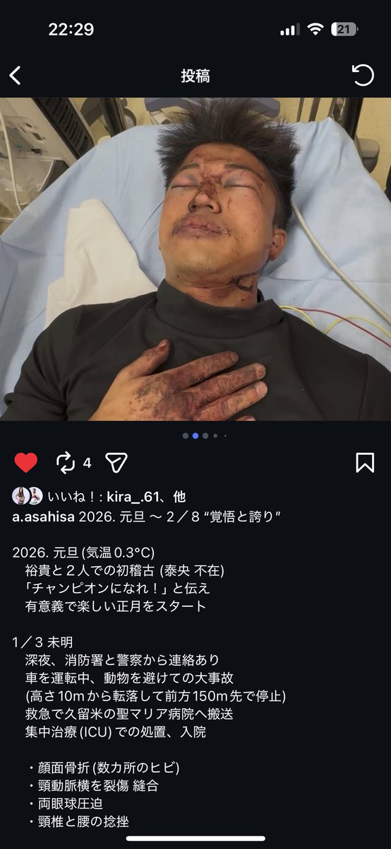 朝久裕貴選手まじかよこんな状態でやってたのか
去年の泰央選手の肋の骨折といいついてないな朝久兄弟