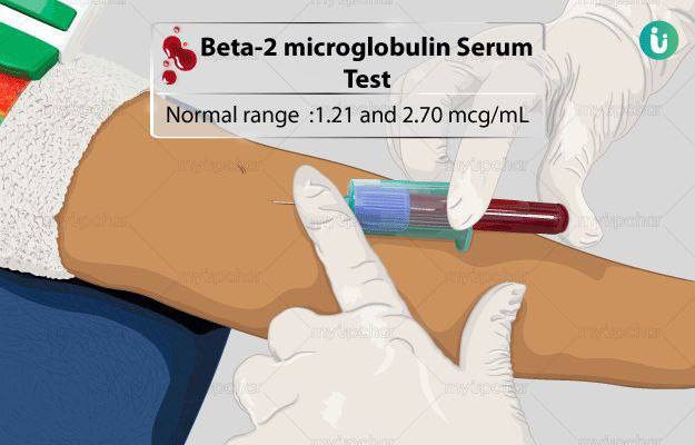 AliAl_khalifah's tweet image. ⭕️تحليل :

B2 Microglobulin
لماذا يجب القيام بهذا الفحص؟
• للمساعدة في تقييم شدة الميلومة المتعددة(Multiple Myeloma) ، أو سرطان الدم، أو سرطان الغدد الليمفاوية
• للتمييز بين اضطرابات الكلى
• للكشف عن الفشل الكلوي
                🔹🔹🔹
متى يجب القيام بهذا الفحص؟
• عند تشخيص…