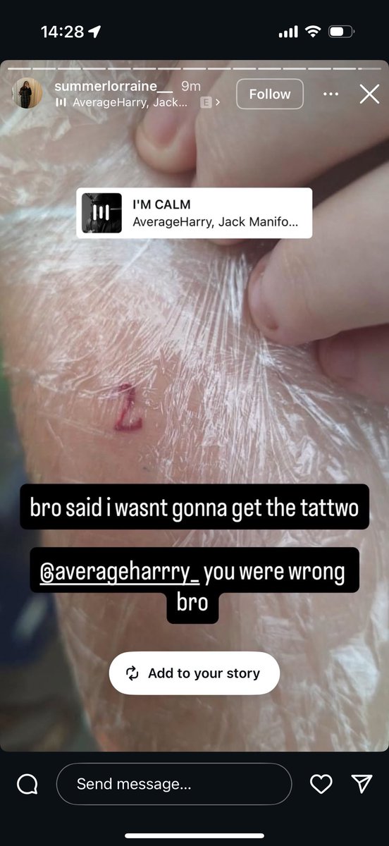 “I love it!! :) I hope that you made an informed decision and I encourage everyone to make sure they treat their bodies well and think hard before doing permanent things like this.”