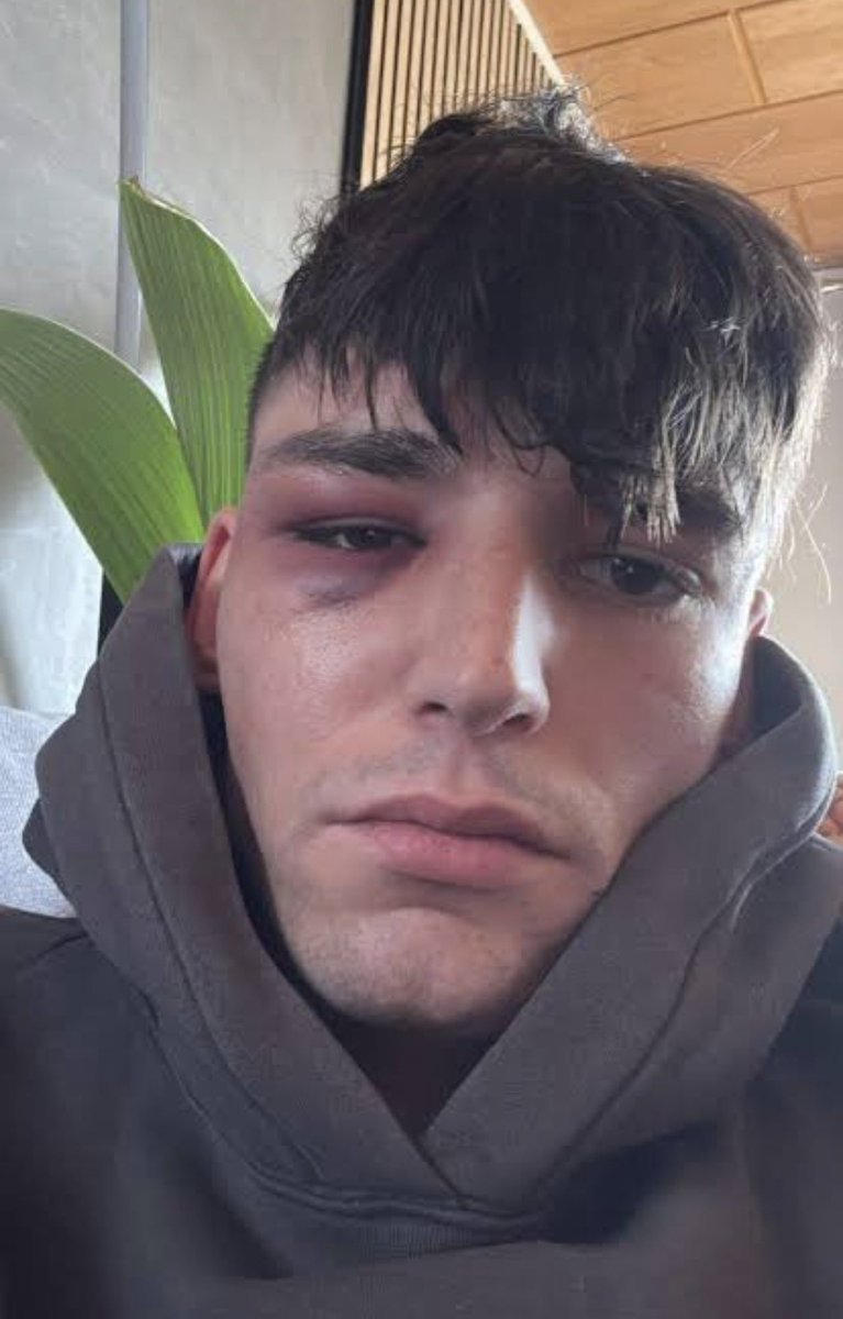 Jesús Tomillero B. ® tweet media