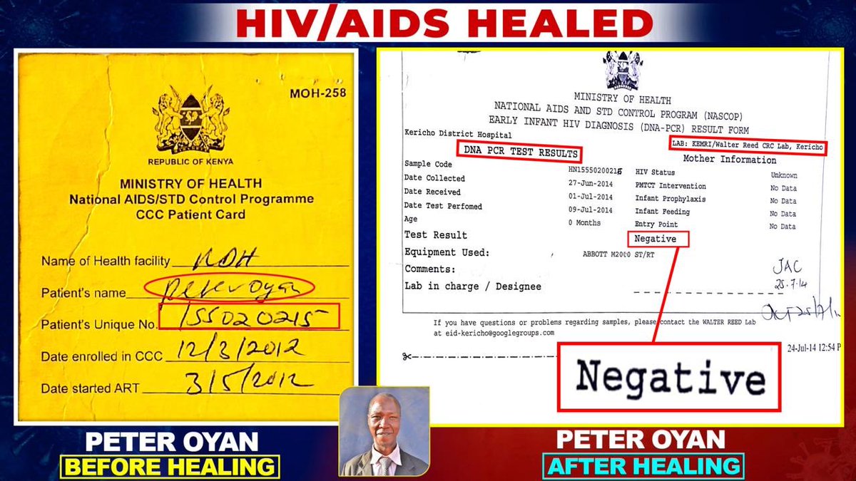 RepentKSMO's tweet photo. Fact:
Peter Oyan has been totally healed and is HIV negative.
#BloodOfJesusHealsHIV https://t.co/bdPwtSO6xP