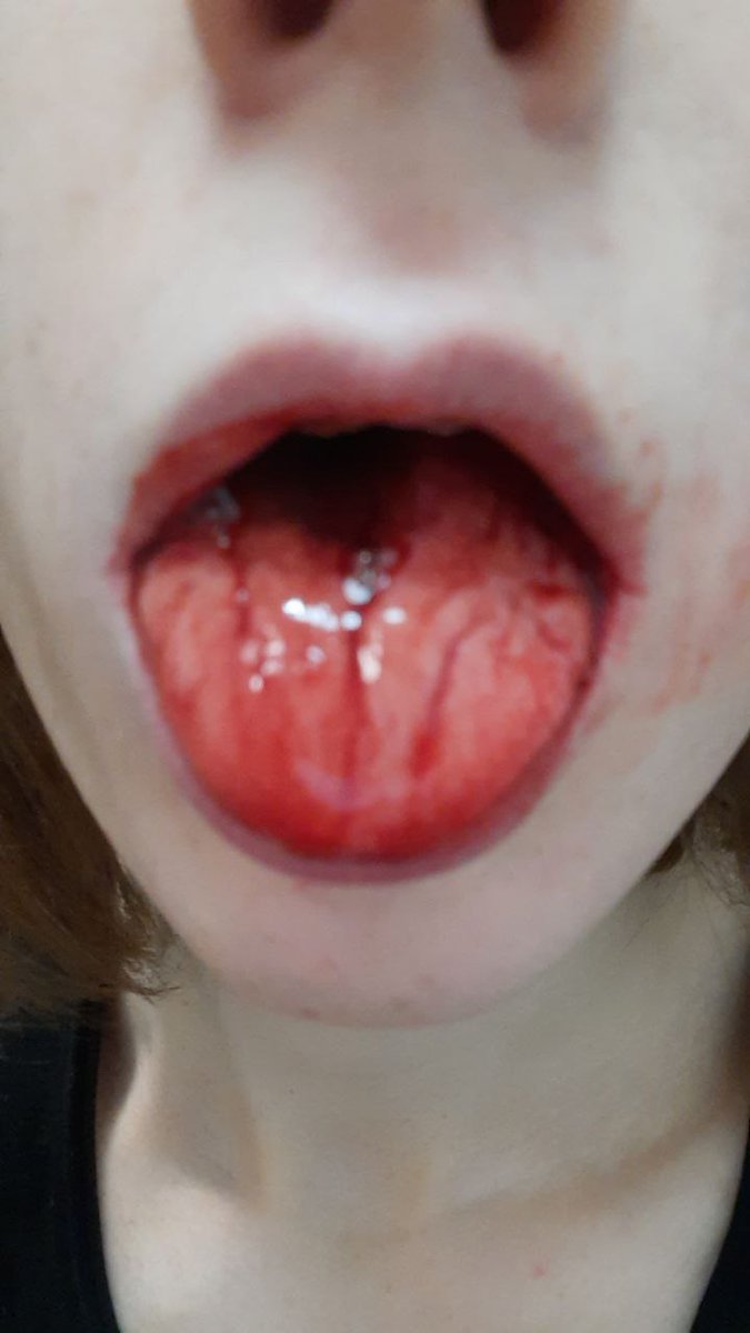 slutelf's tweet photo. Use my neck, uwu~
#trap #femboy #gay #bottom #girl #teen #transgirl #xxx #blood #toungekiss #tounge https://t.co/AGwheAMoA4