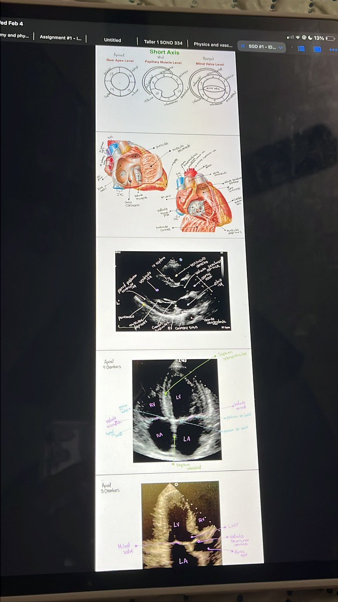 los 26 se sienten y van bien 🌺

la universidad vamos bien, otis el mejor con los regalos y mi hermana exponiendo mis fotos más íntimas jajaja 🤍✨