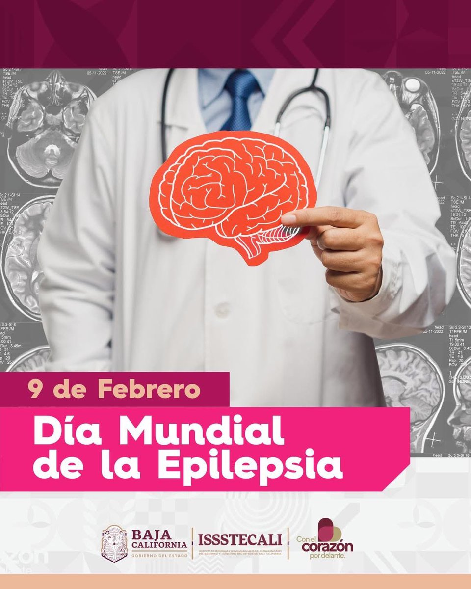Hoy conmemoramos el Día Mundial de la Epilepsia. Hablemos sobre la epilepsia y apoyemos a quienes viven con ella. 

#Epilepsia #Salud #Conciencia