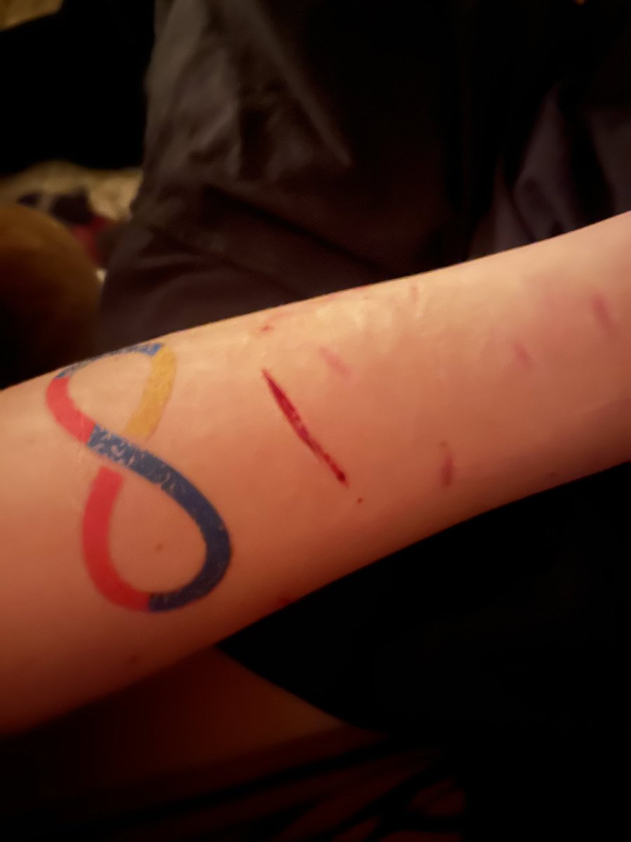 em1n3m33's tweet photo. Styrios
Finally relapsed after so long this is amazing I have blood everywhere https://t.co/z7uptOl0v0
