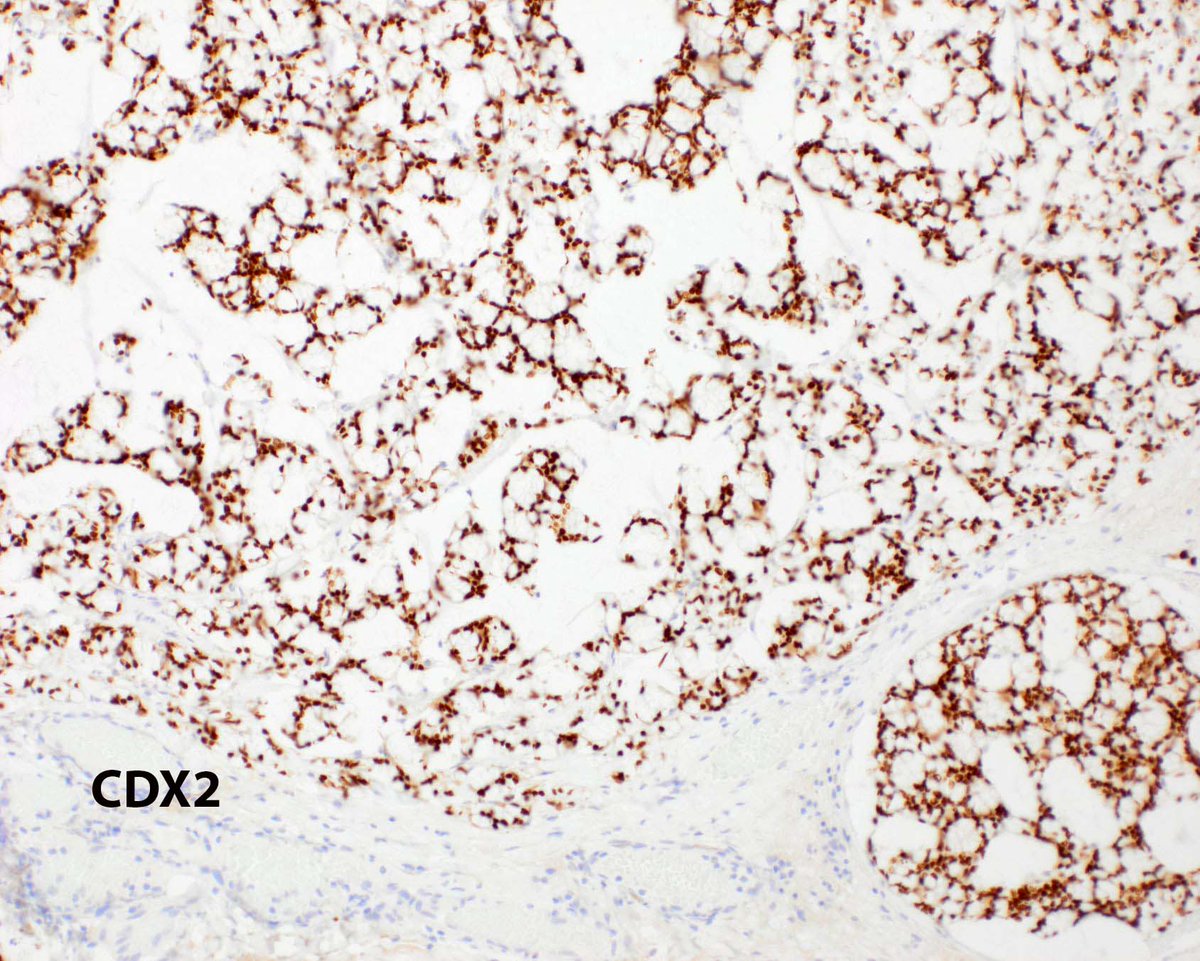 Modern Pathology tweet media