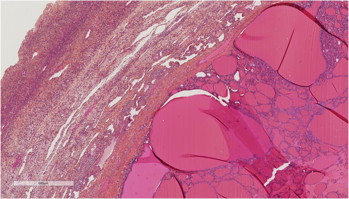 Human Pathology tweet media