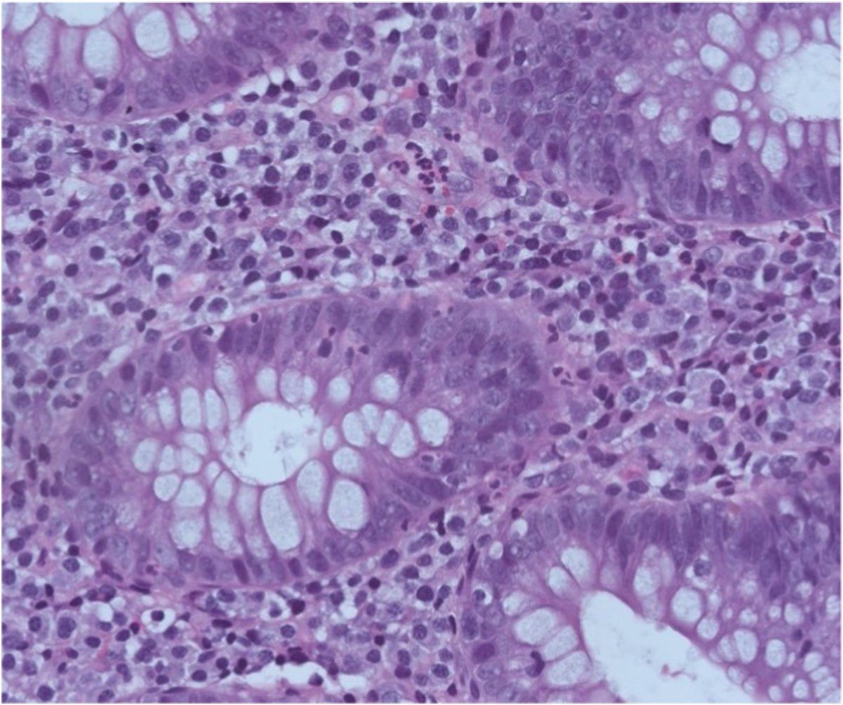 Human Pathology tweet media