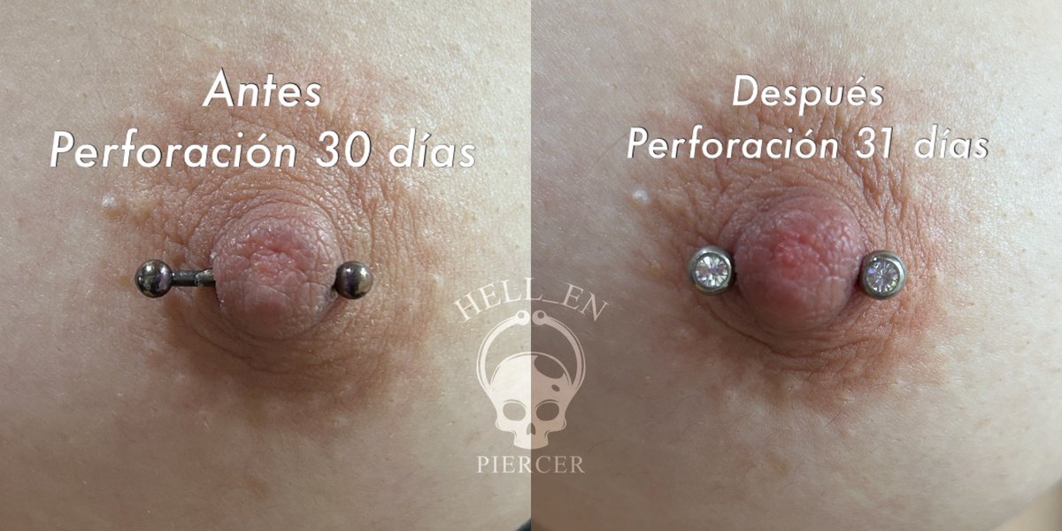 ¡Hacer tu downsize a tiempo evita complicaciones a futuro!😉🔥
El downsize es el cambio obligatorio que debes hacer al largo de tu barra, por lo general se realiza en los primeros meses según la perforación. 
Citas➡️3115888454📲
#nipplepiercing #piercing