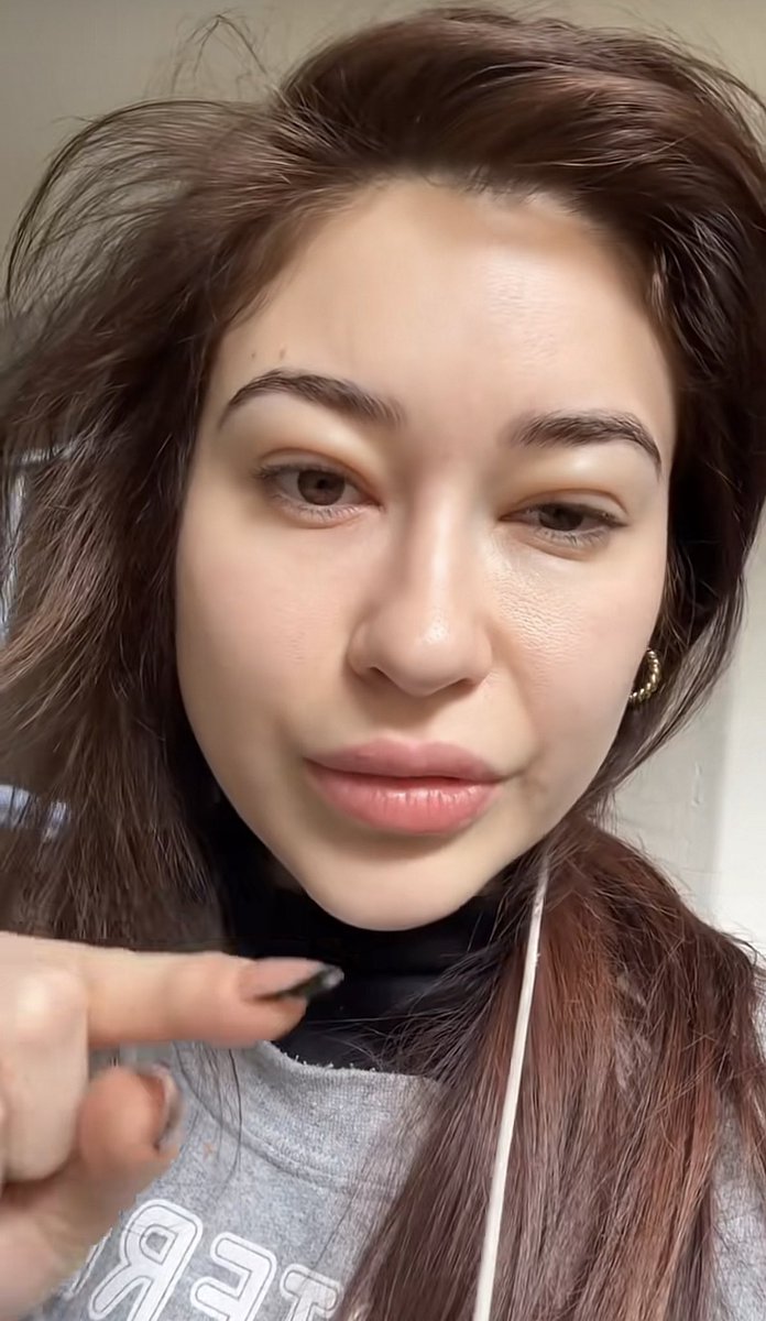 Dianacanela129's tweet image. Fer después de que se dejara de Gabo le dio parálisis facial y amanecía cada día con la cara inflamada. El tipo no le quería dar sus cuentas y Del estrés le dio todo esto
Realmente no necesita evidencia de nada, las que las mirábamos en ese tiempo realmente se miraba mal