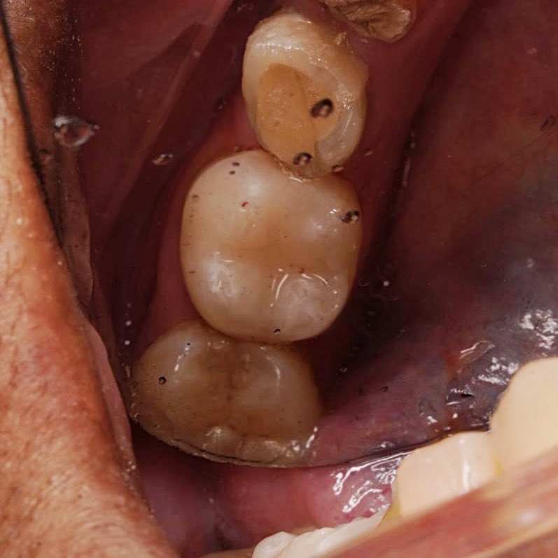 أنـوار الحربي . tweet media