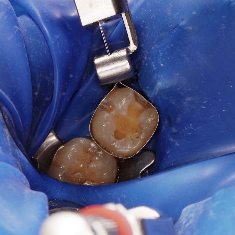 أنـوار الحربي . tweet media