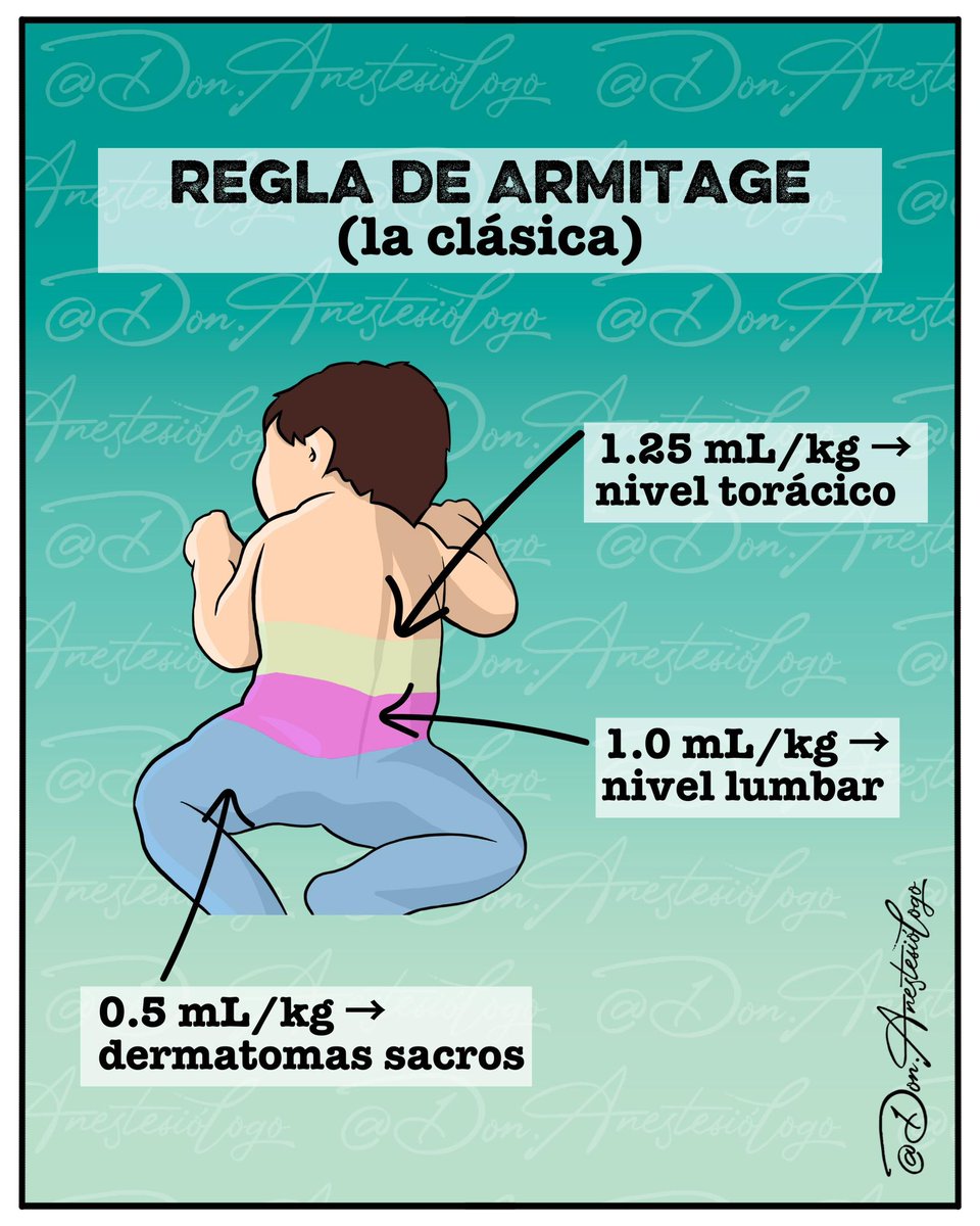 donanestesio's tweet image. ¿Cómo calculas el nivel de la anestesia caudal en pediatría?