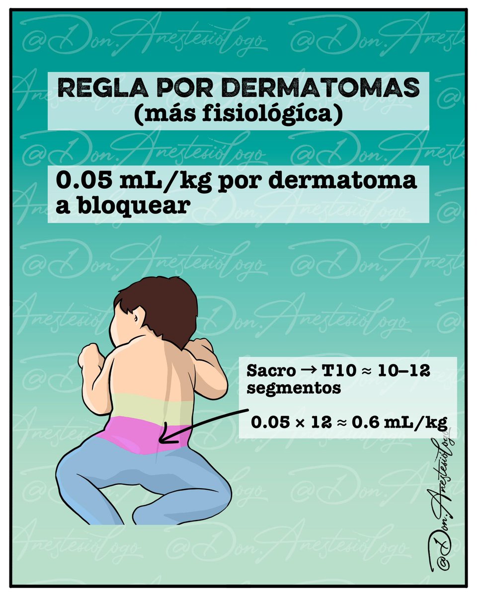 donanestesio's tweet image. ¿Cómo calculas el nivel de la anestesia caudal en pediatría?