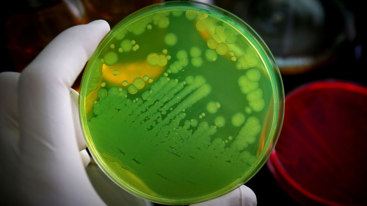 QB3Berkeley's tweet photo. .@UCBerkeley researchers led by QB3-Berkeley faculty affiliate Adam Arkin are engineering healthy lung microbes to outcompete deadly pathogens. The method aims to stop infections without antibiotics.

Read more: https://t.co/OZmJCUqqV9 https://t.co/wueU0d3HtK