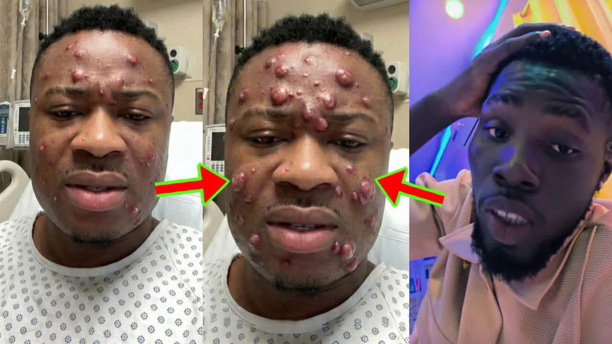 edgesamiri's tweet image. HU ASAANA AKA

Kwame Ato's Cur$e Starts Working Against Trouble Carlos, What's Happening To His Face Will Shock You.
       🤯🥹#vivia #Fights #troublecarlos @Troublecarlos @KwameAtoapoma