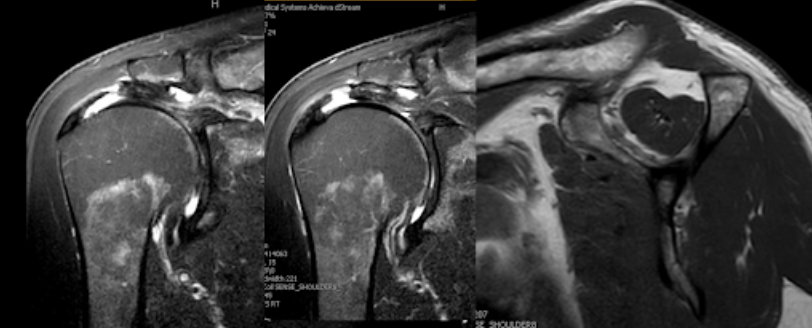 Rick Matsen tweet media