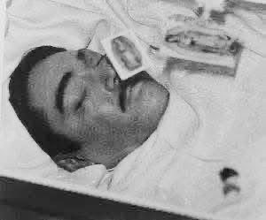 Cuauhtemoc_1521's tweet photo. ¡Las últimas instantáneas realizadas a los rostros de Jorge Negrete y Javier Solís dentro de sus feretros!
Jorge murió meses después de casarse con María Félix, el 5 de diciembre de 1953, debido a complicaciones originadas por una hepatitis C. Tenía 42 años
Javier Solís murió el 19 de abril de 1966 a la edad de 34 años después de una operación de vesícula. Se dice que por consumir líquidos o comer hielo después de su operación, cuando se lo habían prohibido, causando un desequilibrio electrolítico, y después problemas cardíacos. #QEPD 
Quién fue tu preferido?