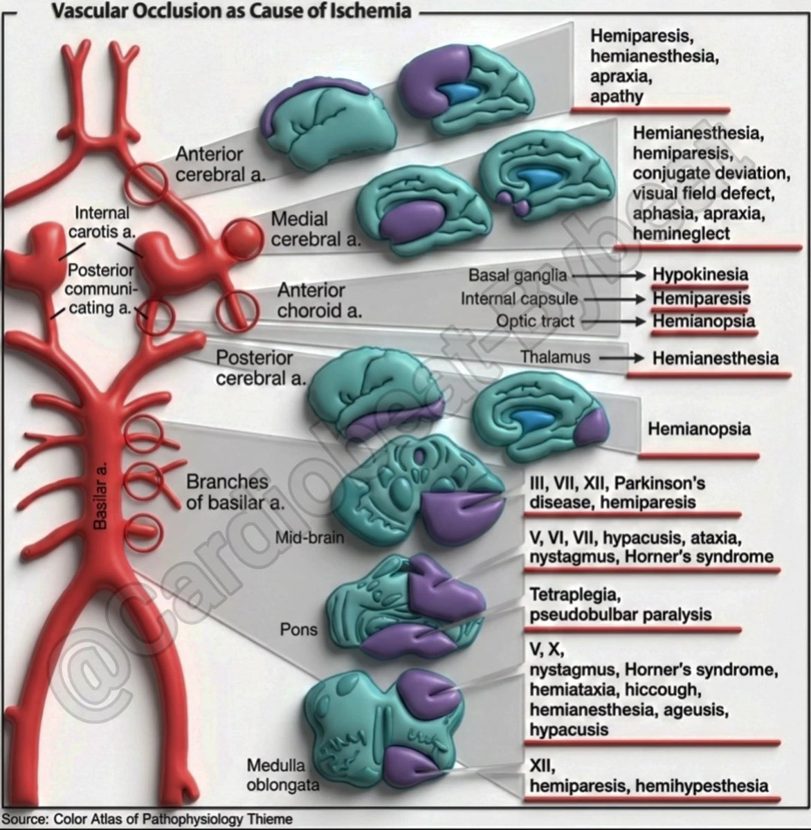 CardioBeat_'s tweet photo. https://t.co/O29aZVq6YG
Stroke Syndromes by Vascular Territory
#StrokeSyndromes #VascularTerritory #BrainInfarction #Neuroanatomy #IschemicStroke https://t.co/EWzUCxMZhO