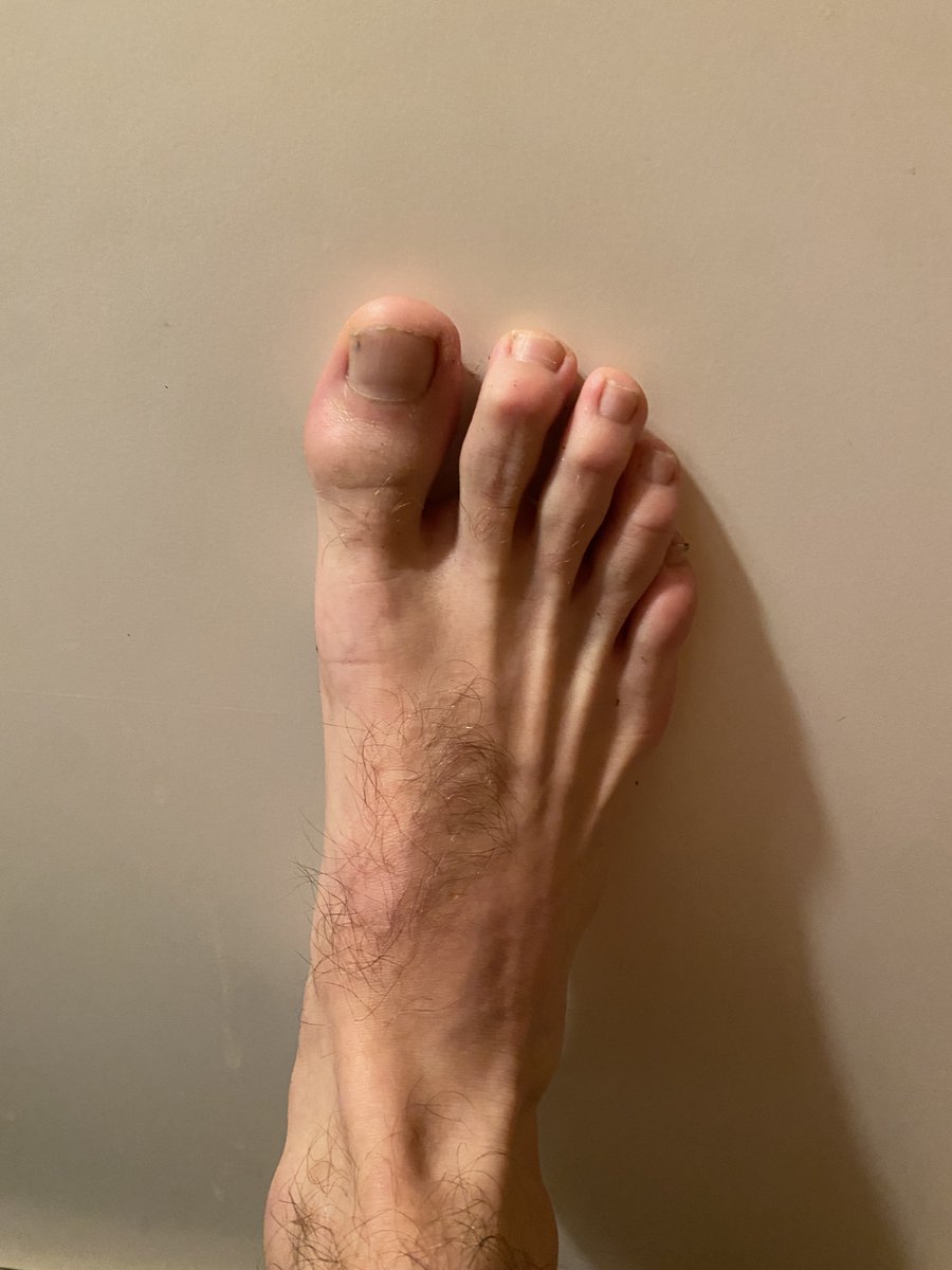 cashsqueezer's tweet photo. Just came from a running session.
go ahead and sniff your screen footboy

#CashPig #PayPig #FinSub #MoneySub #findomfeet https://t.co/tySCevcCA4