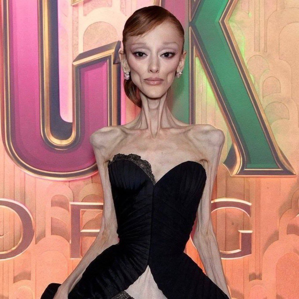 Minha mãe disse que eu to muito magro