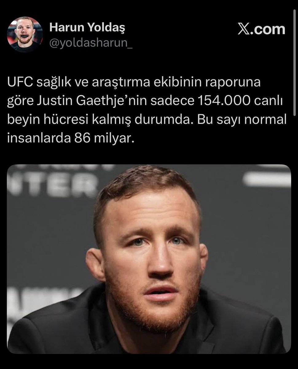 Her gün gece 5te uyumaktan