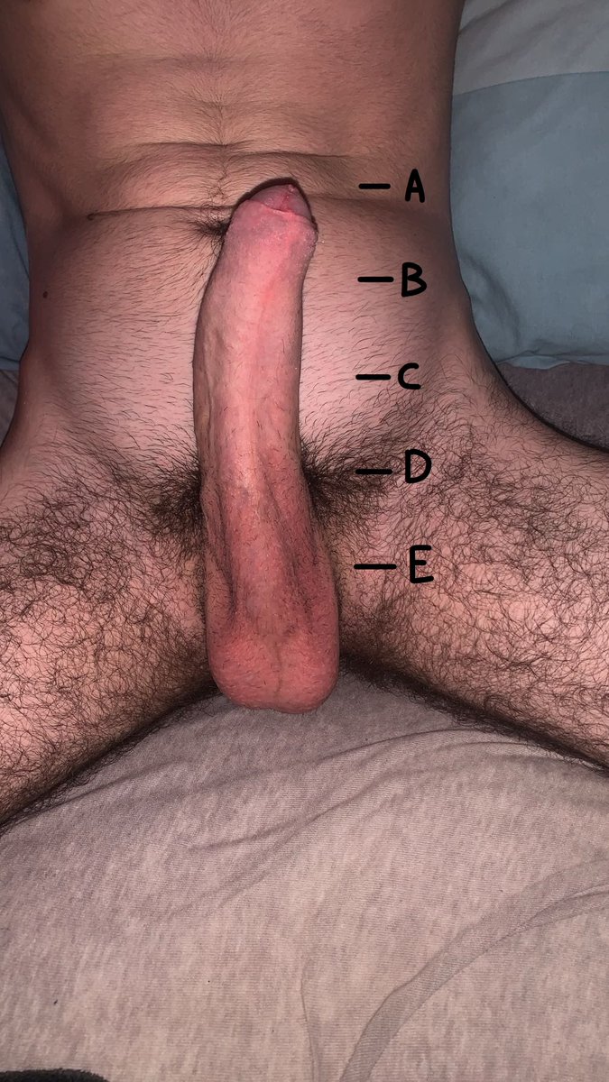 Yokeko ✩ XXL tweet media