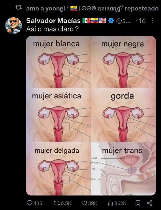 heartzzkoobi's tweet photo. Unf a ella o a mi. 
Tener 1.3k de seguidores y dar rt sin vergüenza a posts: transfobicos, donde te da vergüenza que alguien ponga en alto a los latinos sobre todo con la horrible situación que los latinos están viviendo y siendo tu latina PRO ICE, de vdd un asco.
@slaayoongi https://t.co/Uo2hmg1Sps