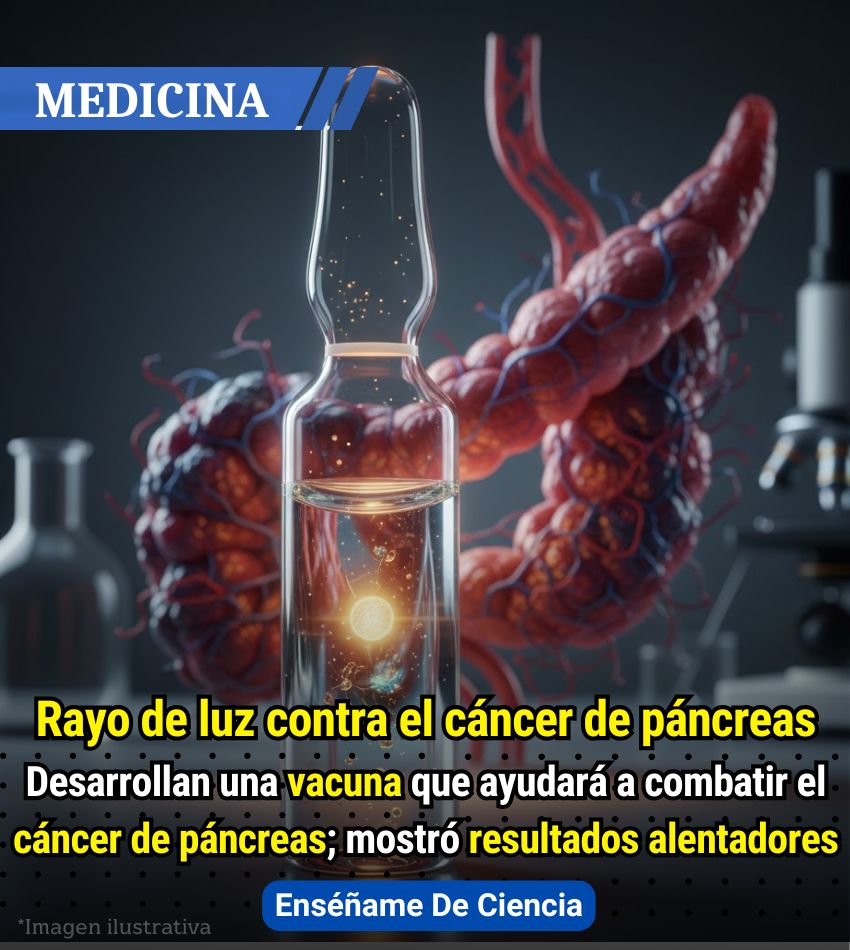 EnsedeCiencia's tweet photo. 🚨Esta vacuna utiliza nanopartículas cargadas con antígenos específicos que entrenan al sistema inmunológico para que puedan reconocer y destruir células cancerosas del adenocarcinoma ductal pancreático. El cual es responsable de más del 90% de los casos de cáncer de páncreas.

Para que los tratamientos sean efectivos, se requiere que se personalice la terapia, analizando de forma individual cada tumor. Sin embargo, el nuevo tratamiento funciona como una solución universal que puede aplicarse a la mayoría de los pacientes.