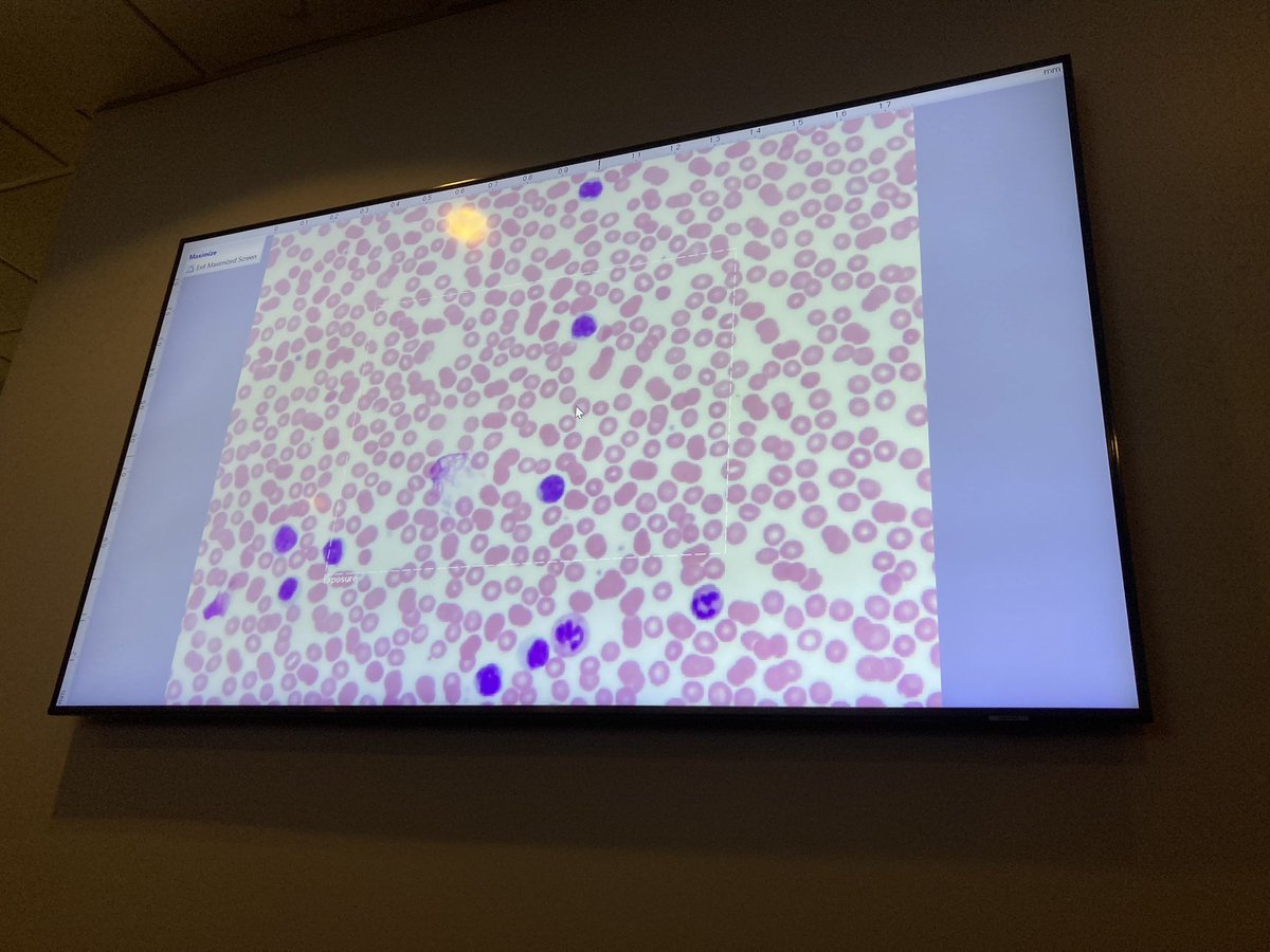 LUC Stritch SOM SCOPE tweet media